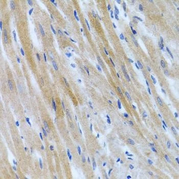 Anti-BMP3 Antibody
