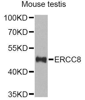 Anti-ERCC8 Antibody