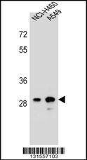 Anti-DHRS4L1 (C-term) Antibody