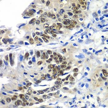 Anti-DACH1 Antibody