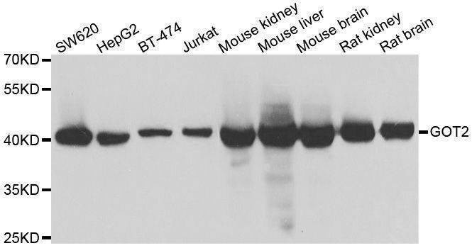 Anti-GOT2 Antibody