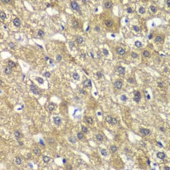 Anti-MYBPC2 Antibody