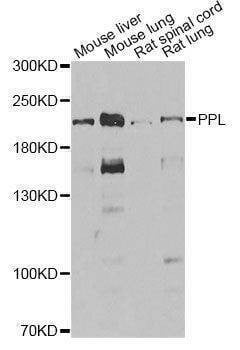 Anti-PPL Antibody