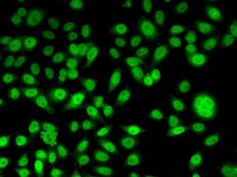 Anti-PPL Antibody