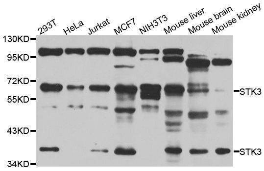 Anti-STK3 Antibody