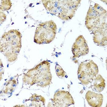 Anti-STK3 Antibody
