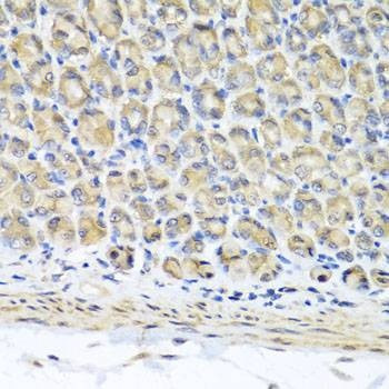 Anti-STK3 Antibody