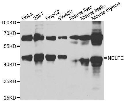 Anti-NELFE Antibody