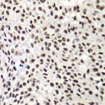 Anti-NELFE Antibody