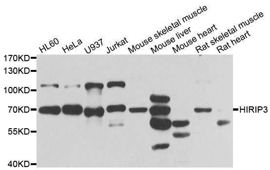 Anti-HIRIP3 Antibody