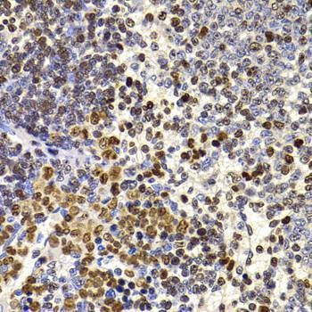 Anti-HIRIP3 Antibody