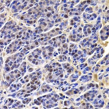 Anti-HIRIP3 Antibody