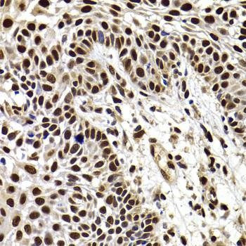 Anti-HIRIP3 Antibody