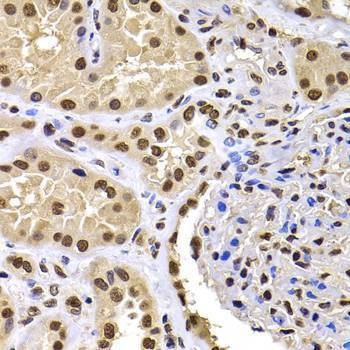 Anti-HIRIP3 Antibody