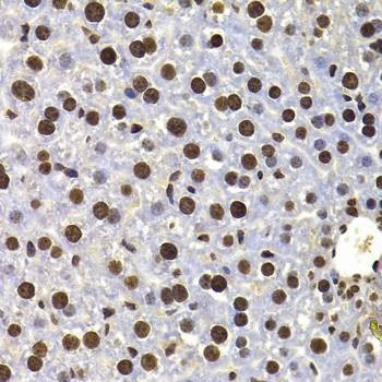 Anti-HIRIP3 Antibody