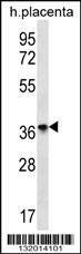 Anti-OR8D4 (C-term) Antibody