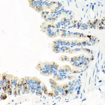 Anti-RGS5 Antibody