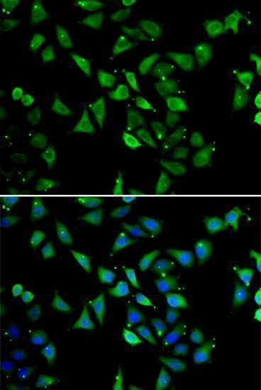 Anti-EIF3C Antibody