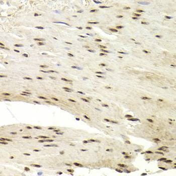 Anti-PRC1 Antibody