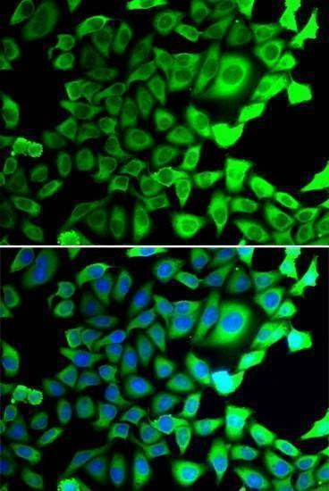 Anti-USP8 Antibody