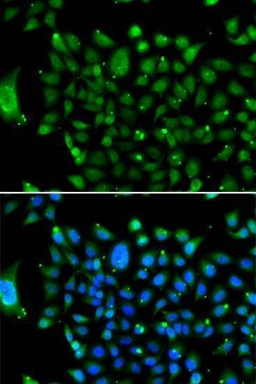 Anti-NCOR1 Antibody