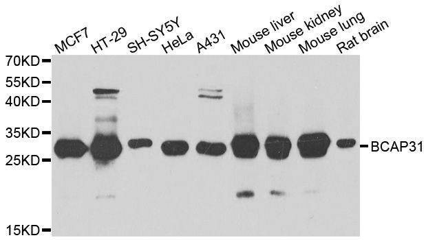 Anti-BCAP31 Antibody