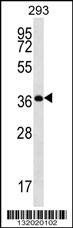 Anti-OR10H5 (C-term) Antibody
