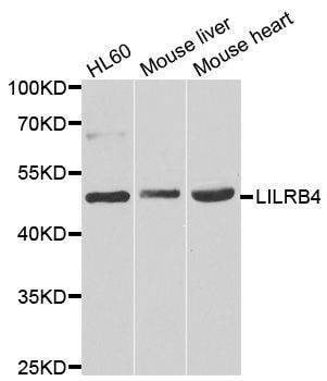 Anti-LILRB4 Antibody
