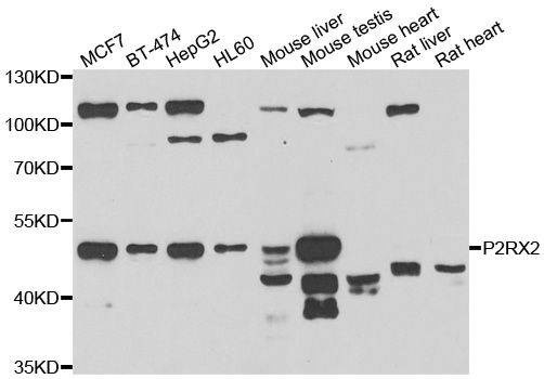 Anti-P2RX2 Antibody