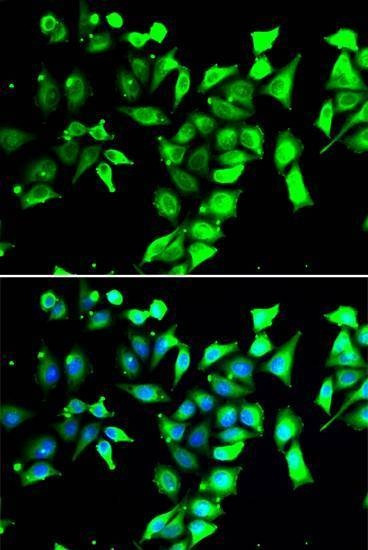 Anti-FKBP8 Antibody