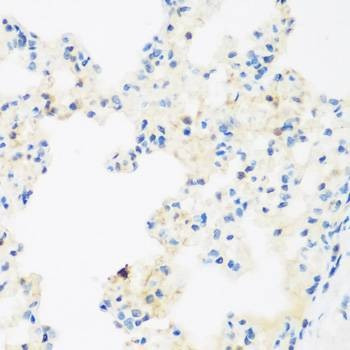 Anti-NFU1 Antibody