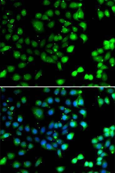 Anti-NTMT1 Antibody