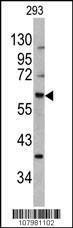 Anti-MDM2 (S166) Antibody