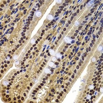 Anti-ACTL6B Antibody