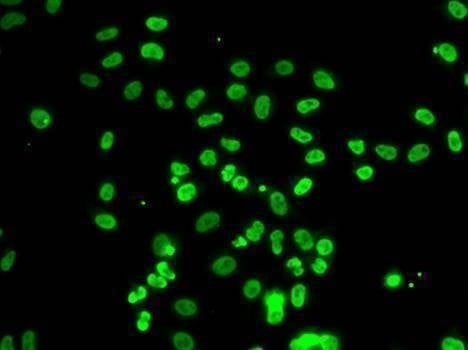 Anti-ACTL6B Antibody