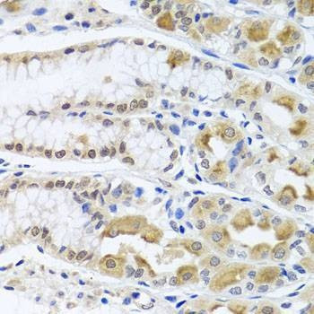 Anti-TRMT1 Antibody