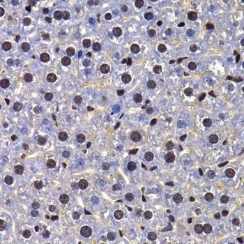 Anti-FIP1L1 Antibody