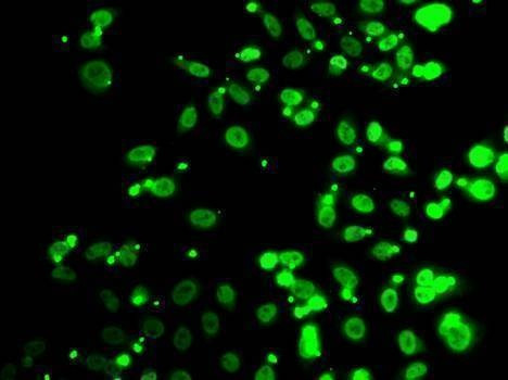 Anti-FIP1L1 Antibody