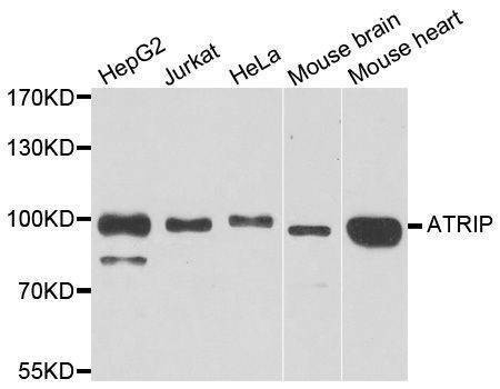 Anti-ATRIP Antibody