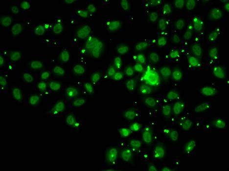 Anti-ATRIP Antibody