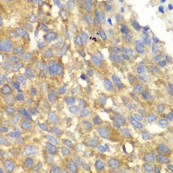 Anti-EIF2AK4 Antibody