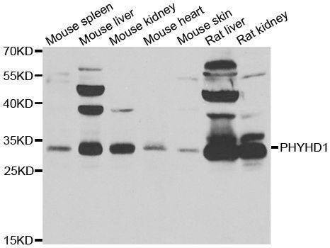 Anti-PHYHD1 Antibody