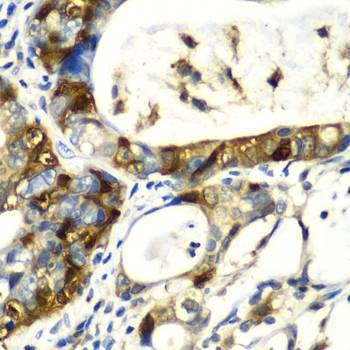Anti-SNCA Antibody
