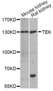 Anti-TEK Antibody
