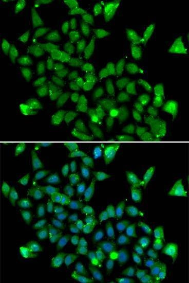 Anti-ASPA Antibody
