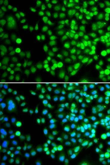 Anti-BCAS3 Antibody