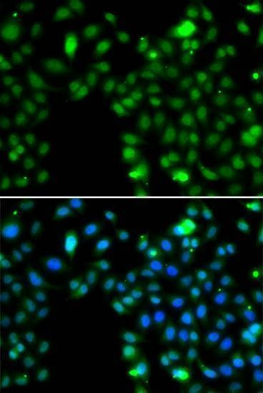 Anti-ING5 Antibody
