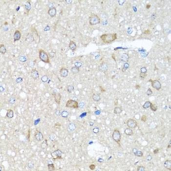 Anti-PRKAG1 Antibody