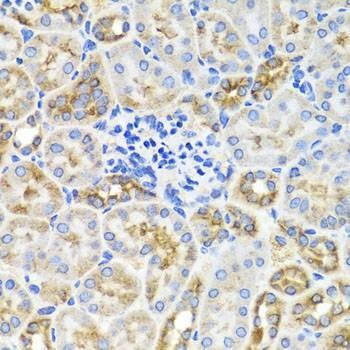 Anti-PRKAG1 Antibody
