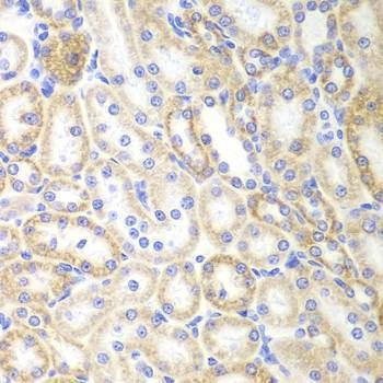 Anti-SIRT3 Antibody